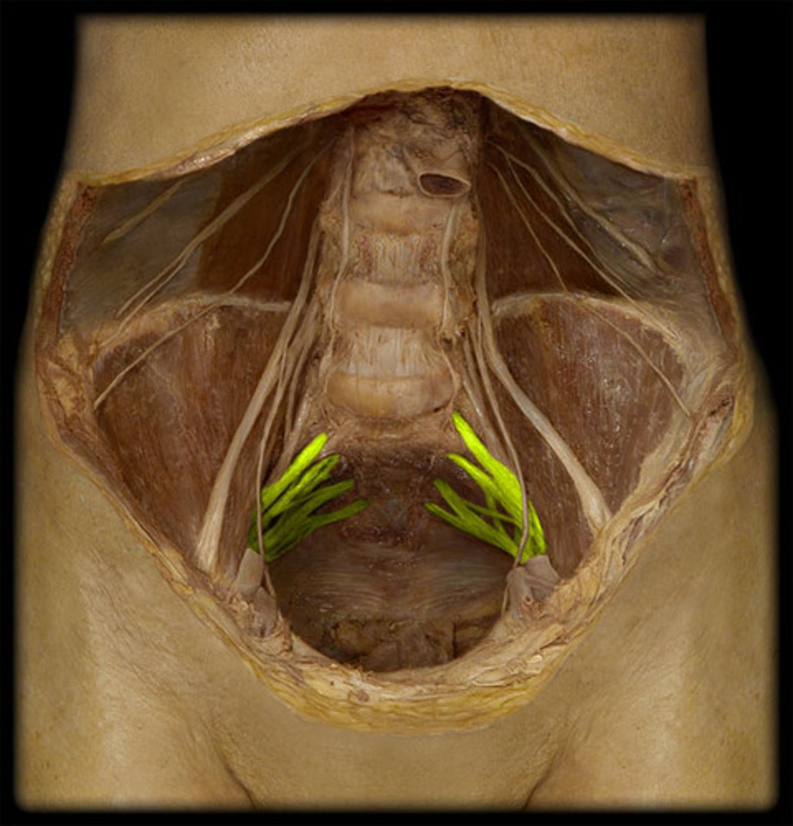 <p>-deep in pelvic floor</p><p>-lateral</p>