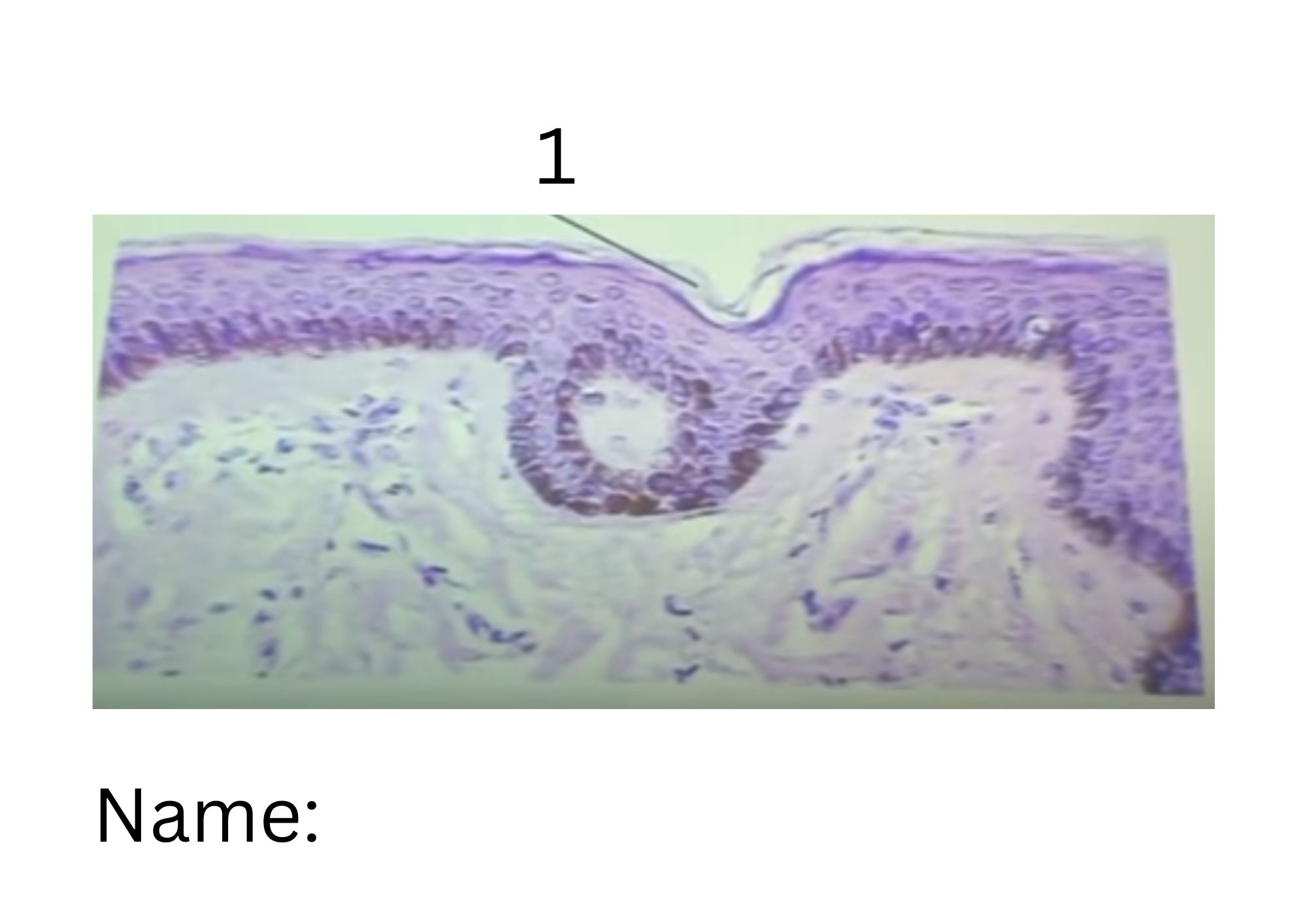 term image