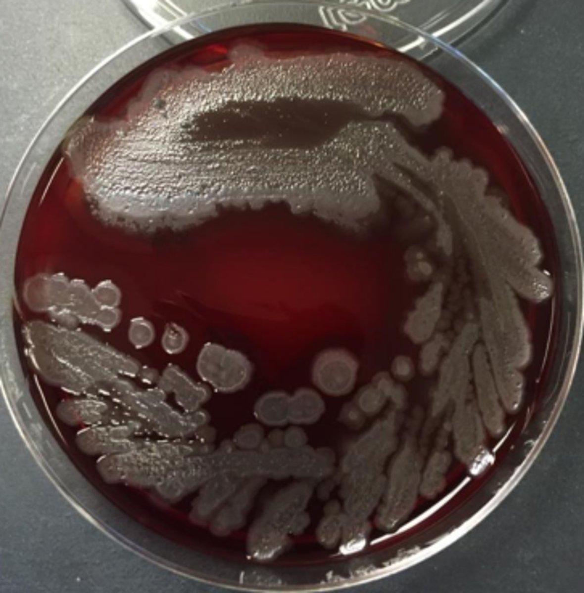 <p>Can be B-hemolytic</p><p>Can be mucoid</p><p>Can be metallic</p><p>Grow on blood, chocolate, MacConkey</p><p>Grape Kool-Aid odor</p><p>Maybe corn tortilla chips</p>