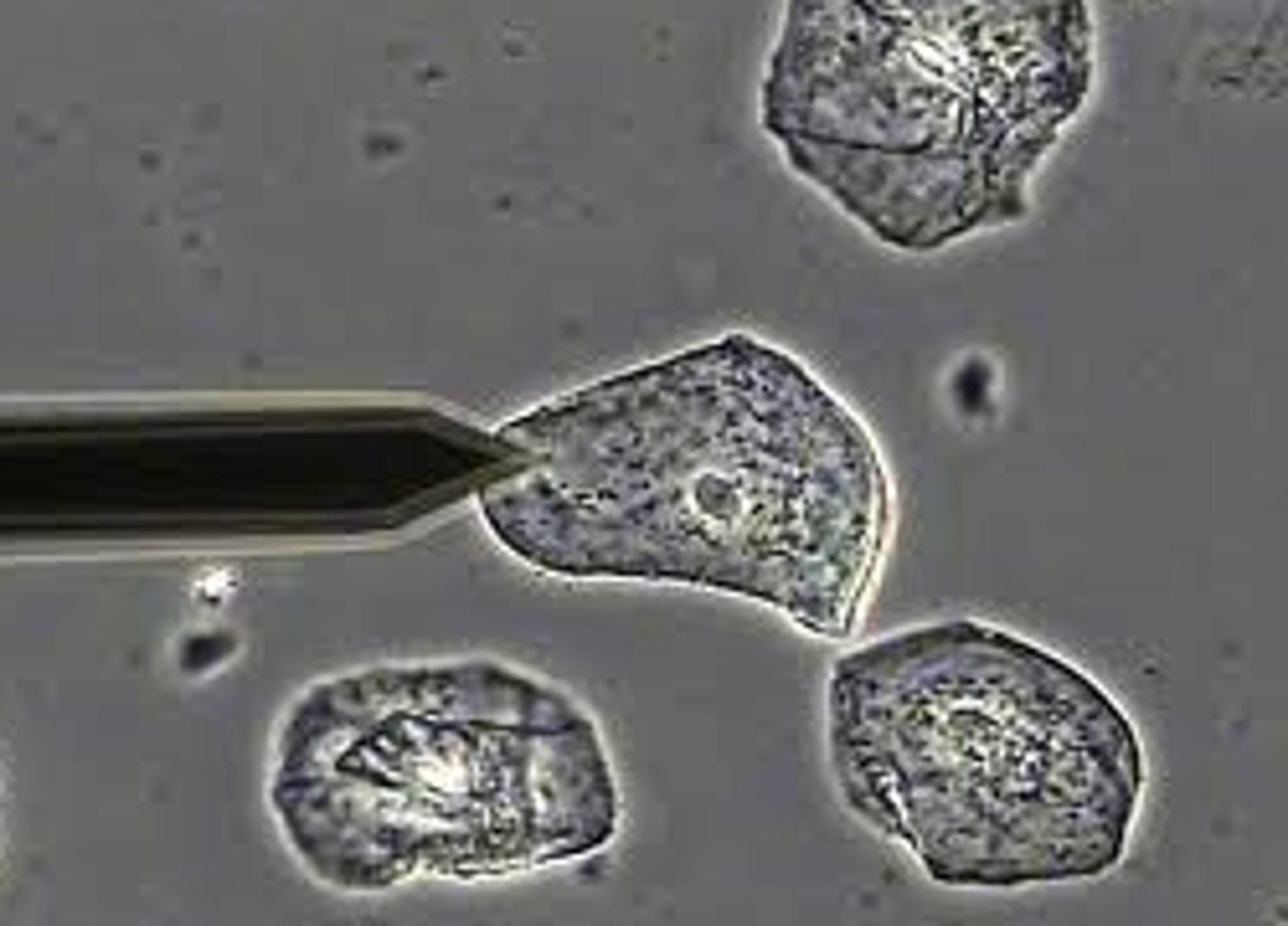<p>- enhances visualization of the elements with low refractive indices, such as hyaline casts, mixed cellular casts, mucous threads, and Trichomonas</p>