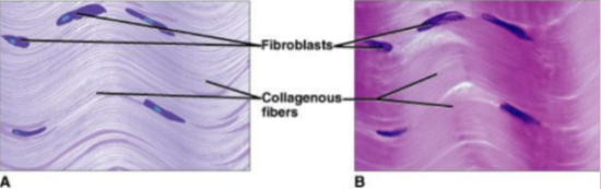 <p><span>1. consists of<strong> DENSELY packed collagenous fibers</strong> and is<strong> very strong but lacks a good blood supply.</strong></span></p><p style="text-align: justify"><span>2. It is found as <strong>part of tendons and ligaments.</strong></span></p>
