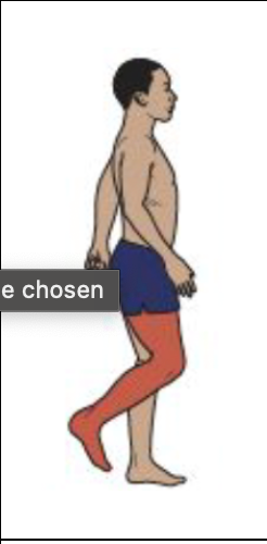 <ul><li><p>Initial Swing to Midswing</p></li><li><p>Ankle motion</p></li><li><p>Pre-tibial muscles elevate the foot to neutral by mid-swing and then maintain that posture.</p></li></ul><p></p>