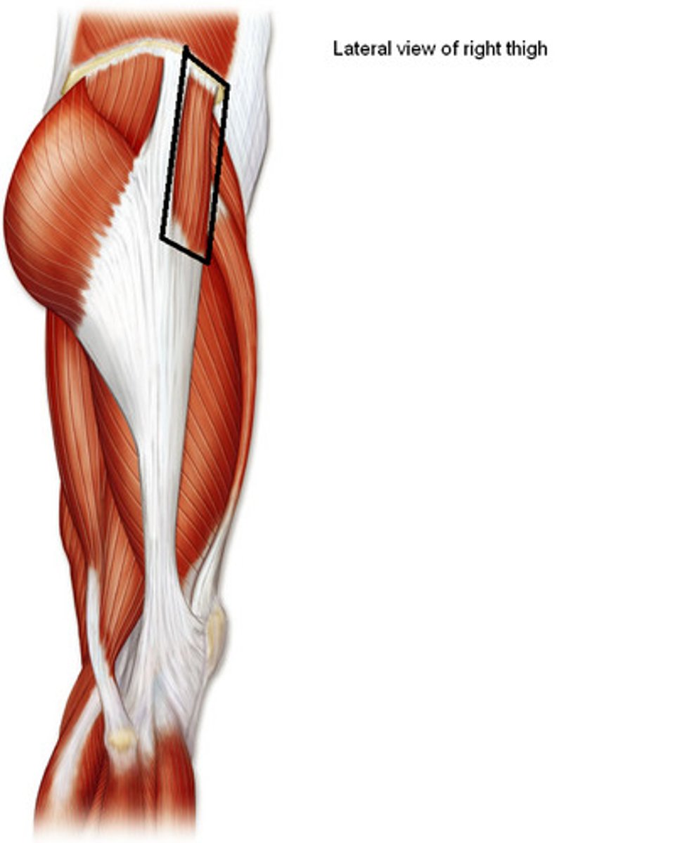 <p>Origin: Anterior superior iliac spine</p><p>Insertion: Iliotibial tract</p><p>Action: flexes and abducts hip, tenses fascia lata</p>