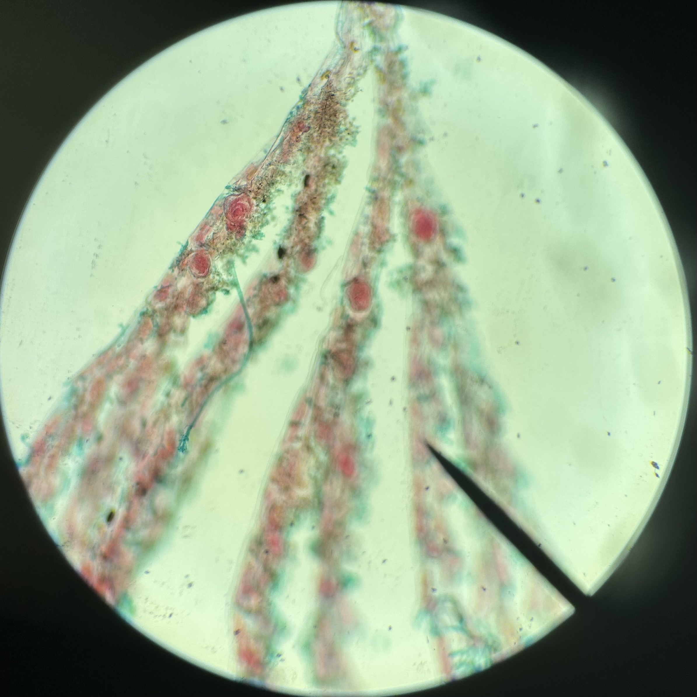 <p>Identify the organism and the Phylum it belongs to</p>