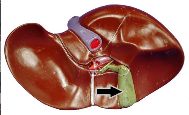 <p>What structure is indicated by the arrow</p>
