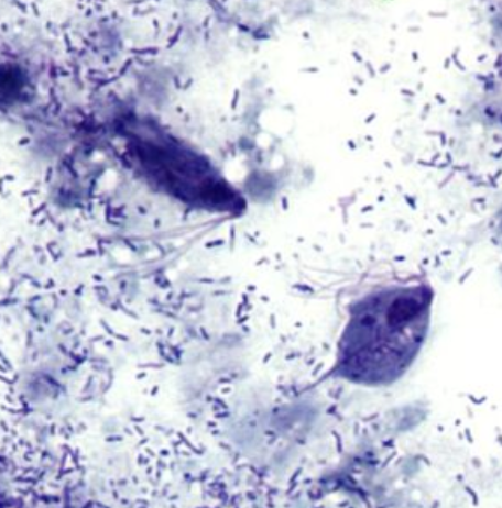 <ul><li><p style="text-align: justify;"><span style="background-color: transparent;"><span>Identify the organism. Give genus and species.</span></span></p><ul><li><p style="text-align: justify;">(1)</p></li></ul></li><li><p style="text-align: justify;"><span style="background-color: transparent;"><span>What is the morphologic stage of the organism?</span></span></p><ul><li><p style="text-align: justify;">(2)</p></li></ul></li><li><p style="text-align: justify;"><span style="background-color: transparent;"><span>What is the specimen of choice for the detection of the organism?</span></span></p><ul><li><p style="text-align: justify;">(3)</p></li></ul></li></ul><p></p>