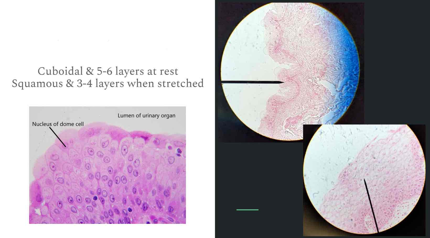 Epithelial Tissue Flashcards Knowt