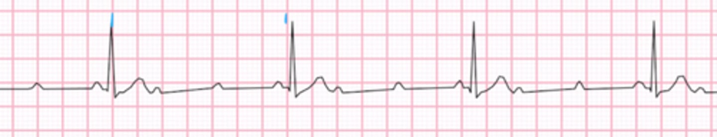 <p>Name the rhythm</p>