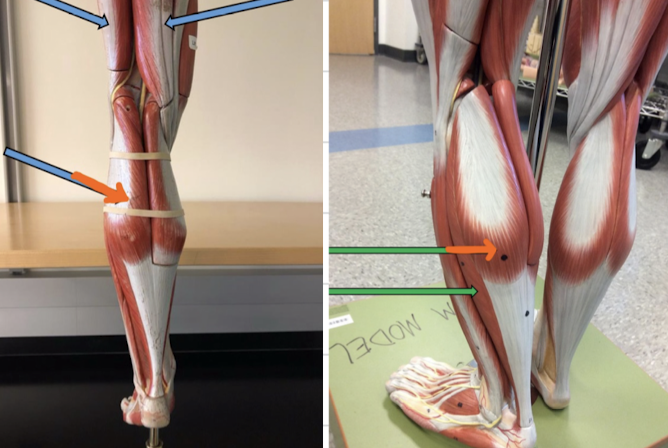 <p>Identify this muscle?</p>