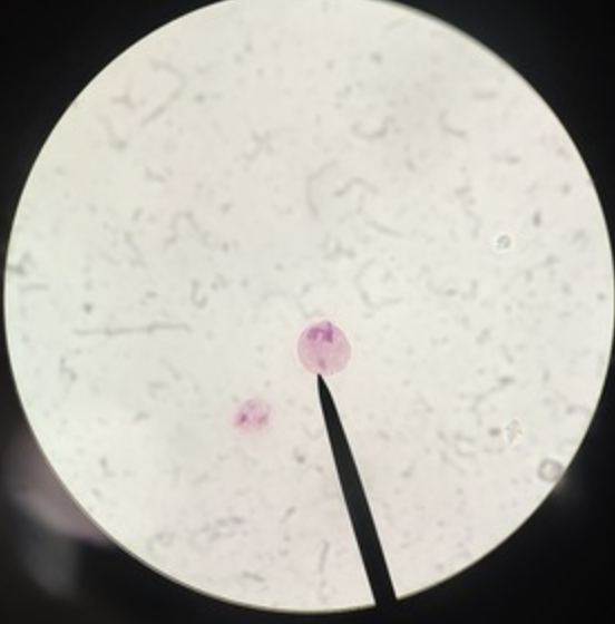 <ul><li><p>identify</p></li><li><p>m.o.t</p></li><li><p>infective stage</p></li><li><p>host</p></li></ul><p></p>