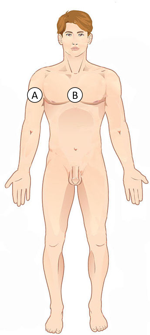 <p><span><span>Label B is __________ to label A</span></span></p>
