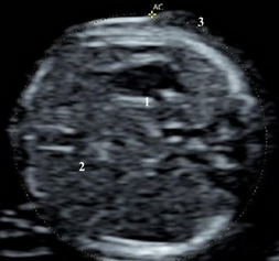 <p><span style="line-height: 21.6px;"><strong>Evaluate fetal situs</strong>; what is the presentation of the image?</span></p>