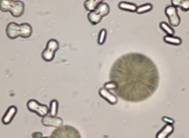 <p>Name this crystal? what is it associated with? what is its pH? normal or abnormal? </p>