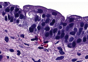term image