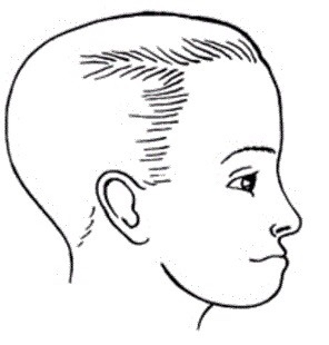 <p>prominent protruded mandible</p>