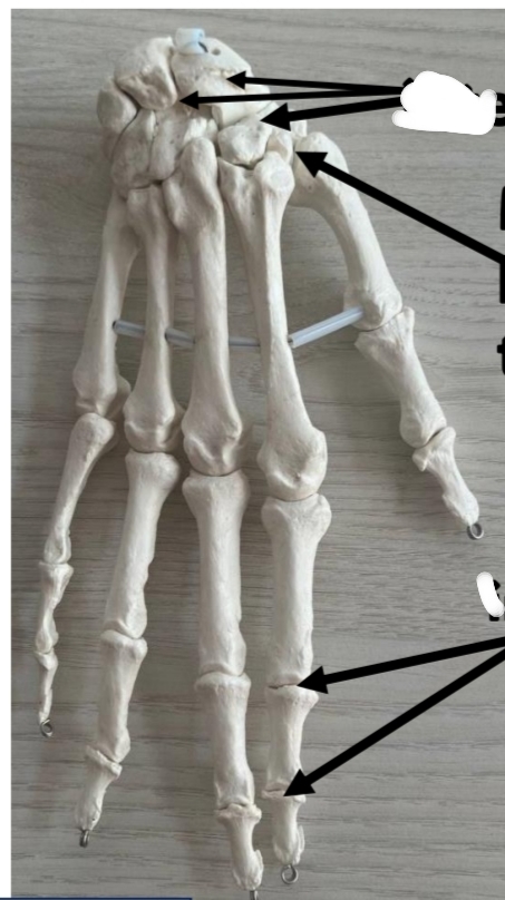 <p>identify the 3 joint types respectively from up to down </p><p>mention their types according to the shape of articulating bones respectively</p>