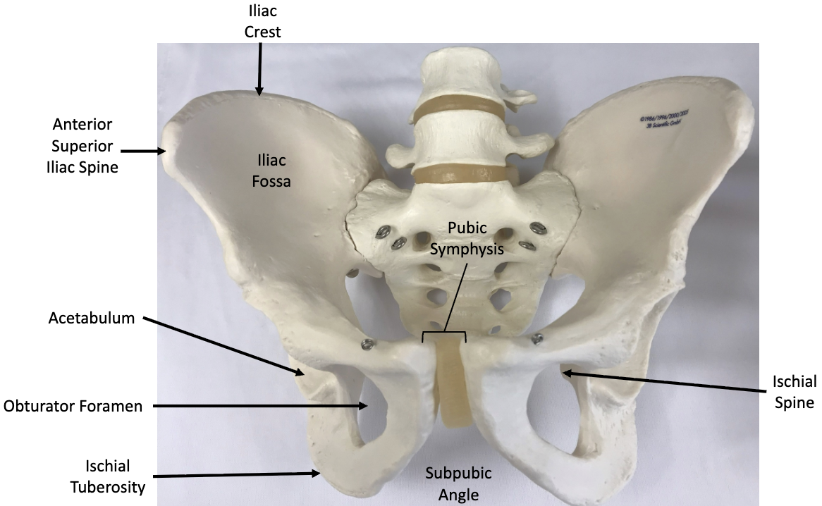 <p>Is this a male or female pelvis?</p>