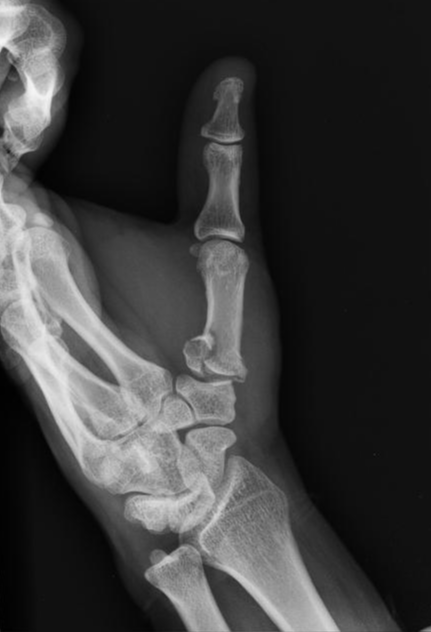 <p>Describe the abnormality demonstrated.</p>