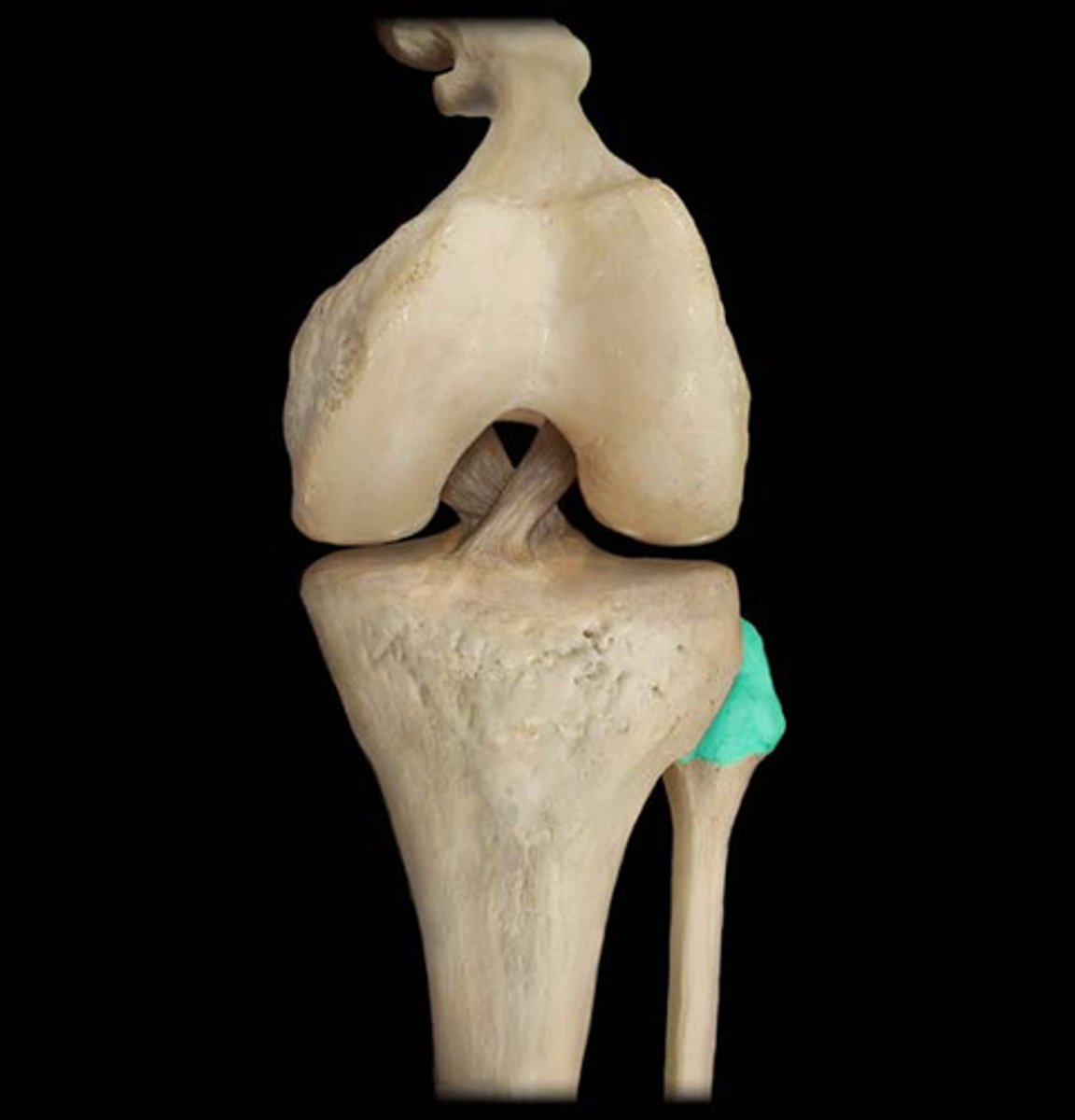 <p>inferior and lateral to patella. Find tibial tuberosity and gerdy’s tubercle first</p><p>insertion of biceps femoris</p><p>attachement of fibular collateral ligament.</p><p>posterior, lateral knee</p>