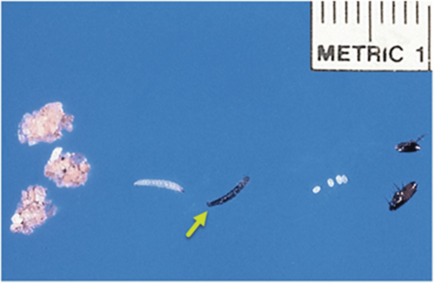 <p>The yellow arrow is pointing to the _____________ life cycle stage of the flea.</p>