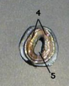 <p>5</p>