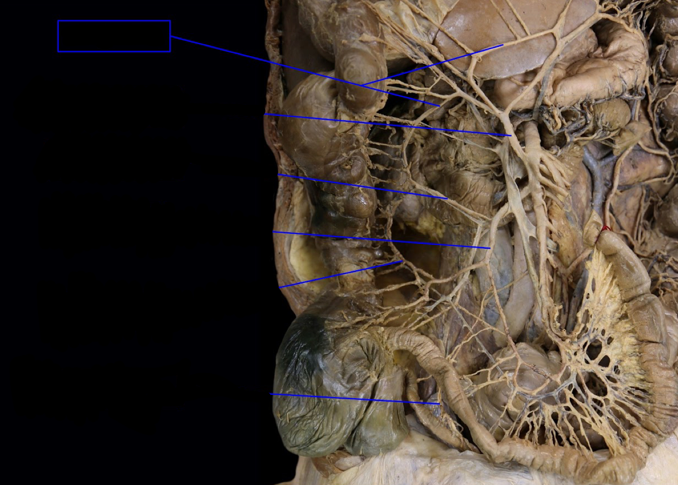 <p>A). Identify this structure<br>B). What other structure come together to form this?</p>