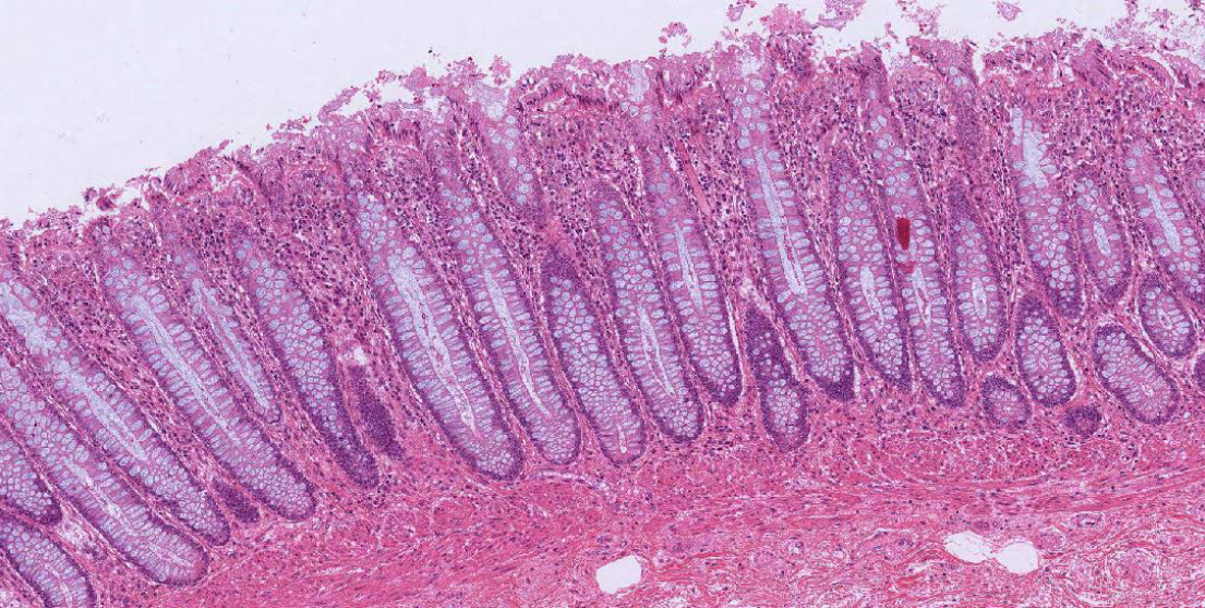 <p>large intestine</p>
