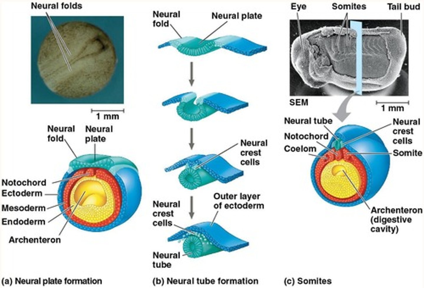 <p>The neural tube, which becomes the central nervous system (brain and spinal cord).</p>