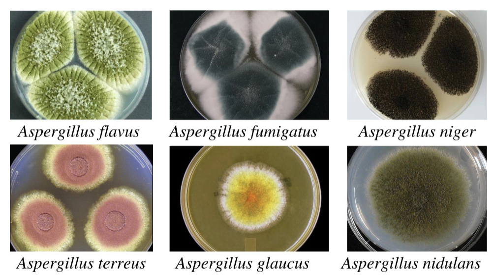 <ul><li><p>respiratory fungal disease</p></li><li><p>cause: <em>Aspergillus fumigatus</em></p><ul><li><p>found in compost piles and decaying vegetation</p></li><li><p>virulence: opportunistic</p></li></ul></li><li><p>transmission: inhalation</p></li><li><p>symptoms: triggers allergic reaction; infects lungs (invasive; immunocompromised)</p></li></ul><p></p>