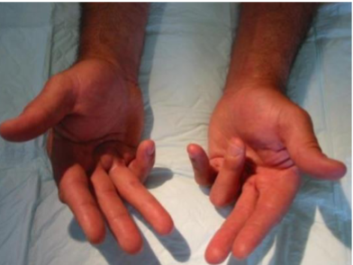 <p>What’s this called &amp; what’s it a sign of</p>