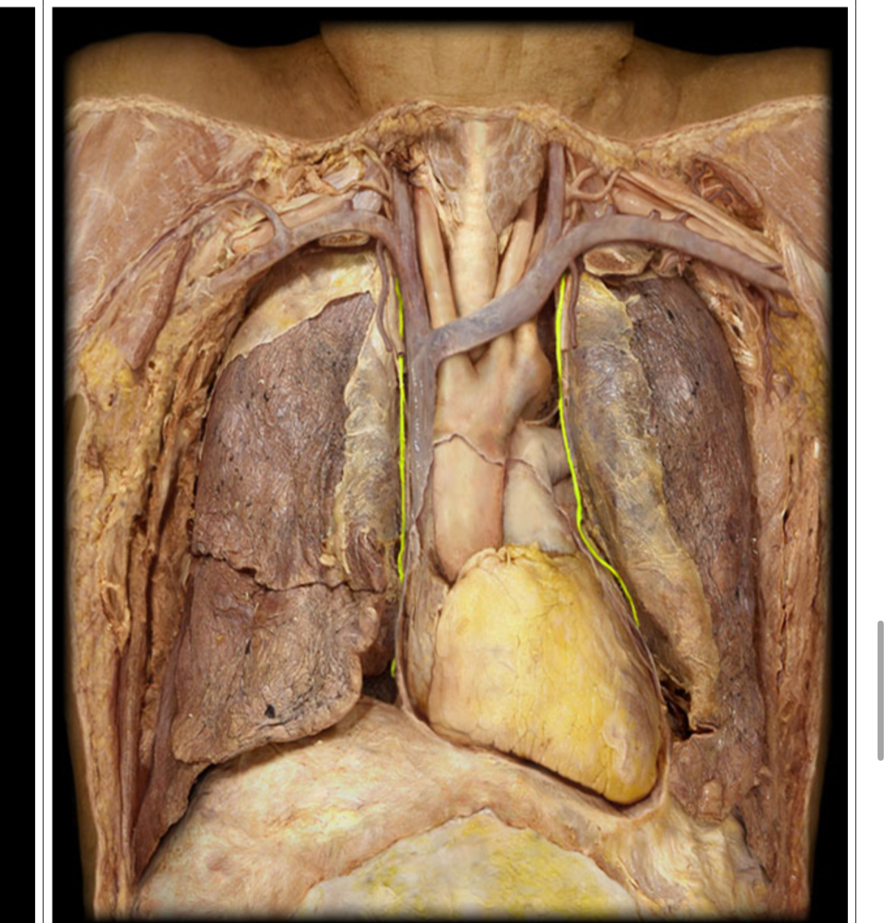 <p>What nerve is this</p>