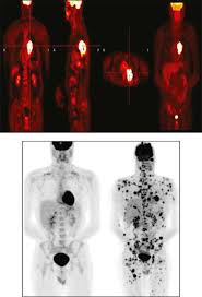 <p>Functional Imaging Nuc Med </p>