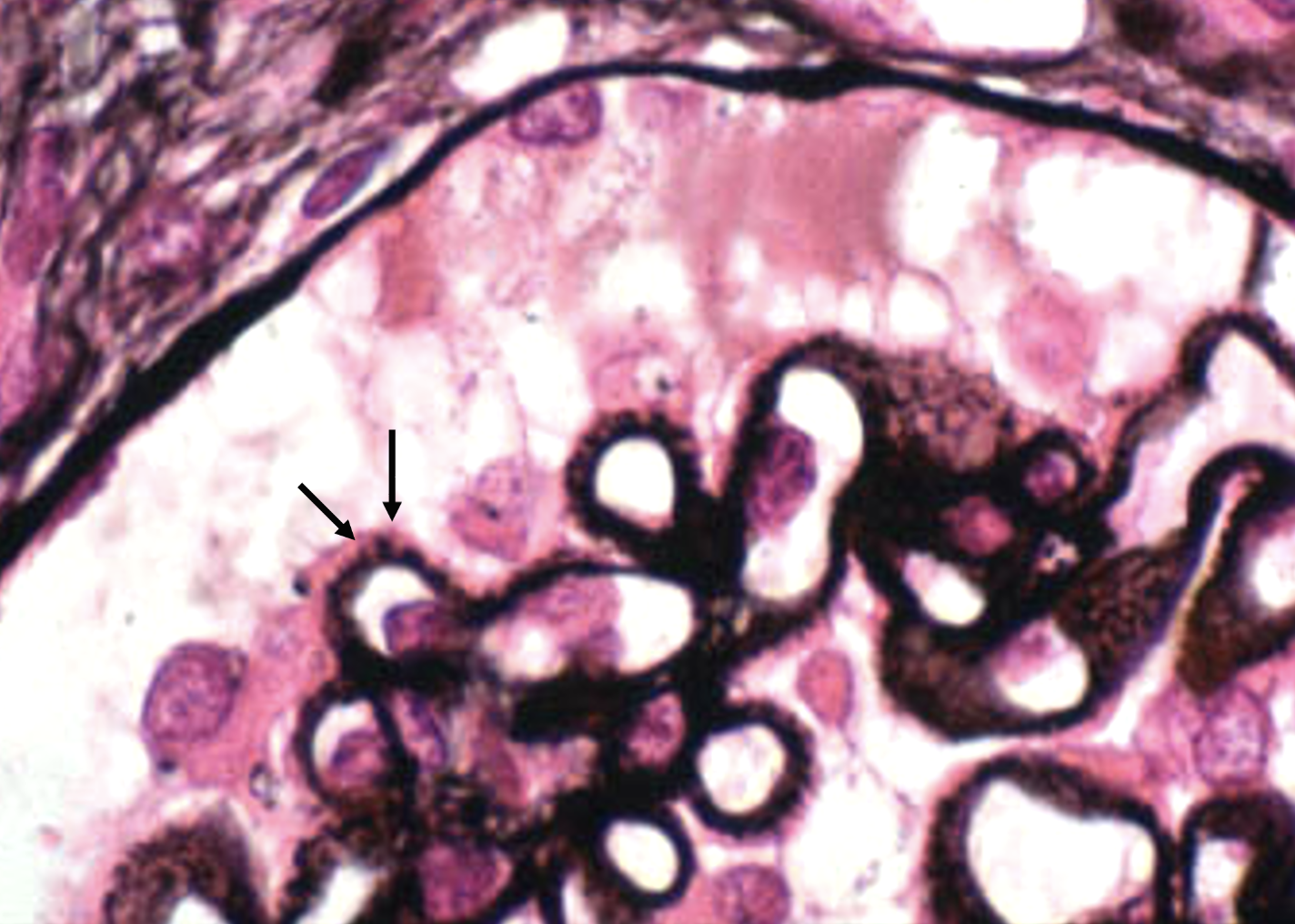 <p>What pathology is indicated?</p>