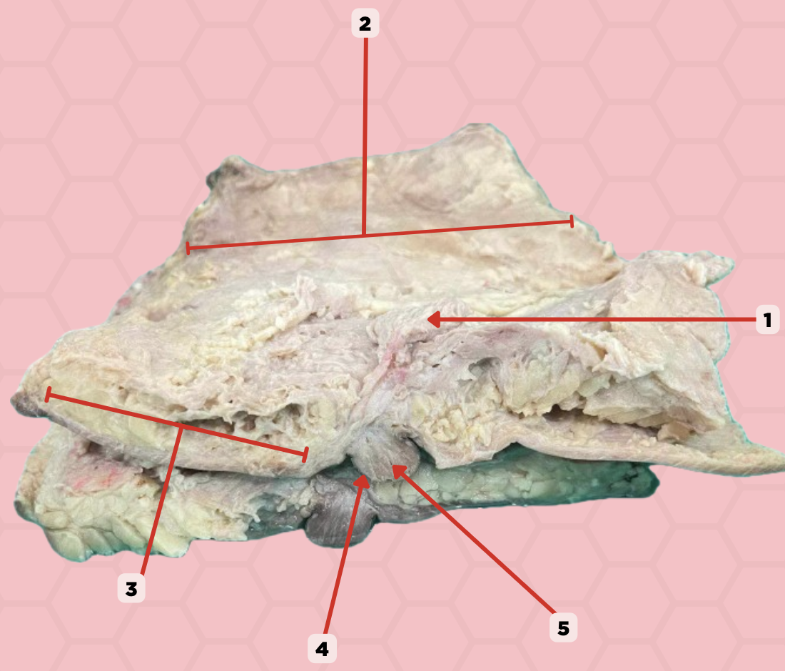 <p>What type of gland is #1?</p><p>a. Modified apocrine serous glands</p><p>b. Merocrine glands</p><p>c. Eccrine sweat glands</p><p>d. Modified apocrine sweat glands</p>