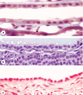 <p>what kind of epithelium are these&nbsp;</p>