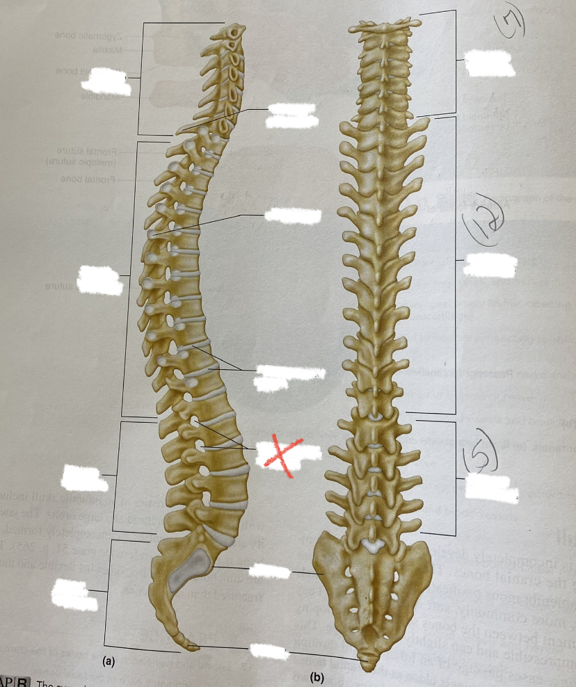 Formed by 2 vertebrae. Spinal nerves emanate here