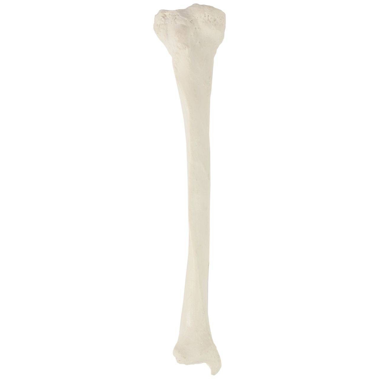 <p>Larger distal leg bone</p>