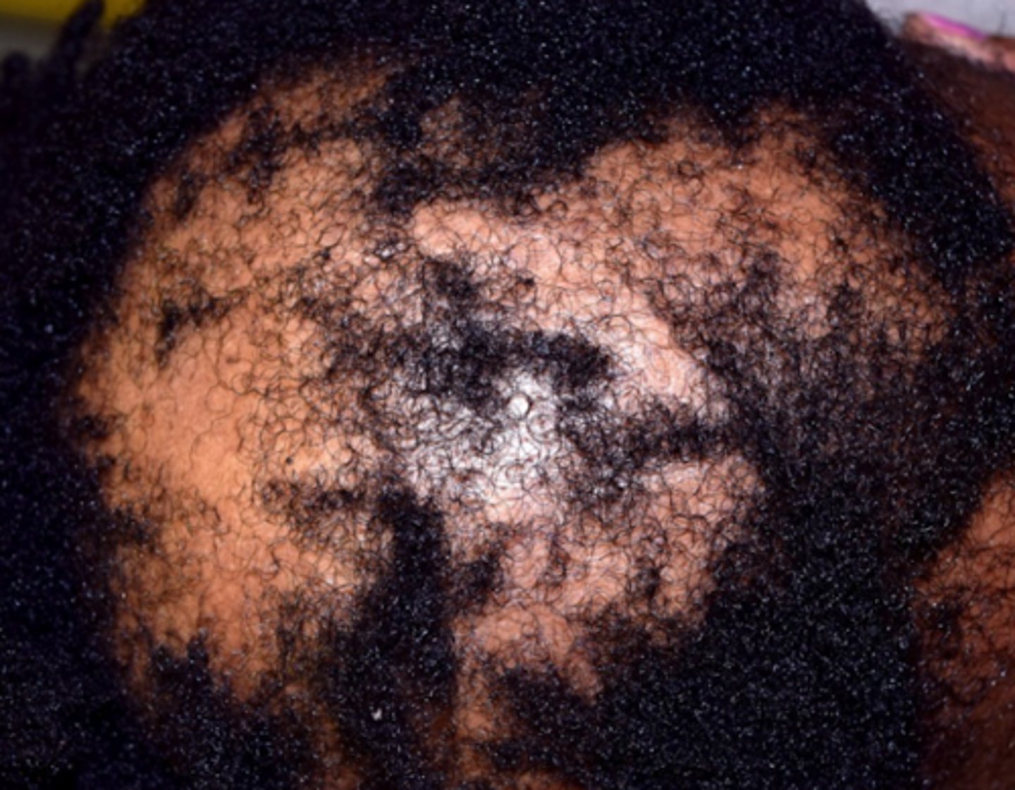 <p>What is the diagnosis?</p>