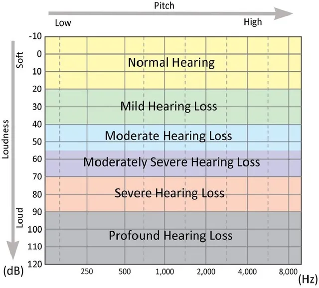 <p>41 - 55 dB HL</p>