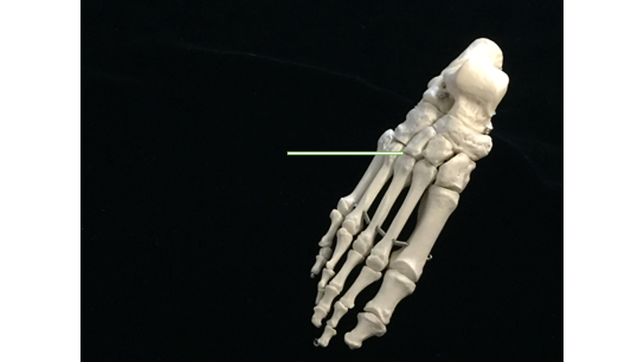 <p><span style="font-family: Lato Extended, Lato, Helvetica Neue, Helvetica, Arial, sans-serif; color: rgb(45, 59, 69)"> name tarsal bone participating in the joint</span></p>