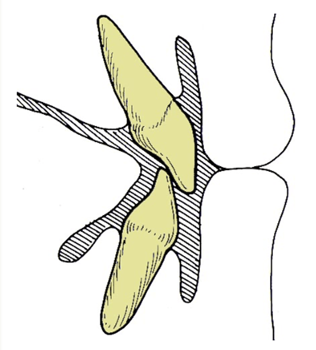 <p>What muscle is indicated in grey, anterior to the maxillary incisor?</p>