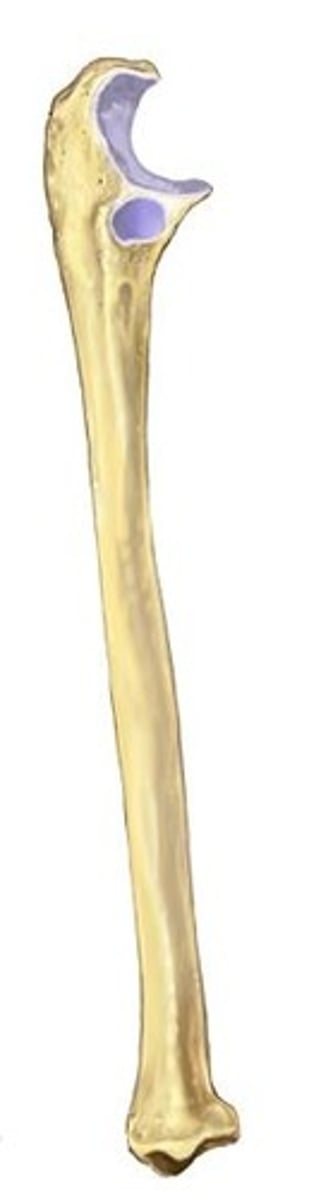<p>ID bone</p>