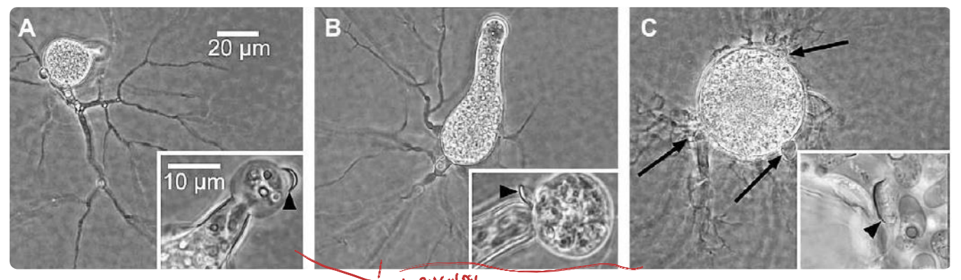 <p>main “body” of chytrid</p>