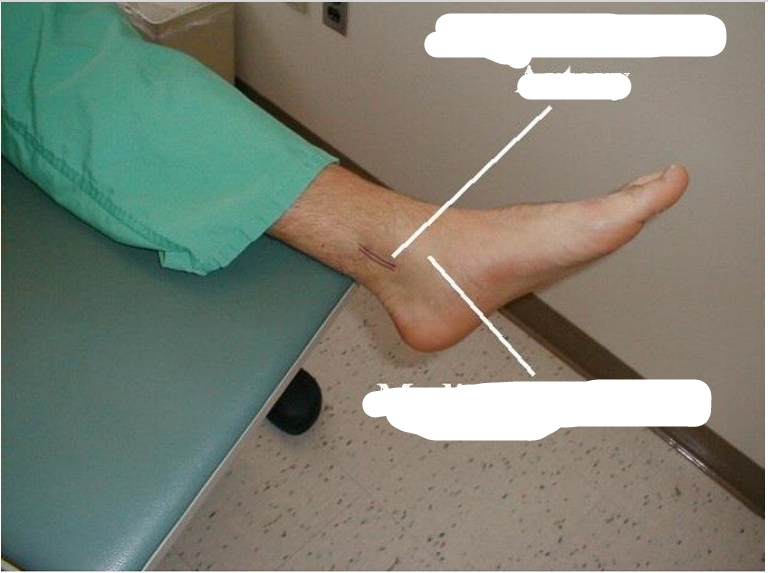 <p>Sites of pulse examination in lower limb </p>