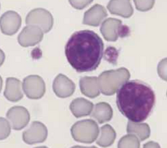 <p>What type of lymphocyte is this?</p>