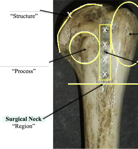 <p>Surgical Neck </p>