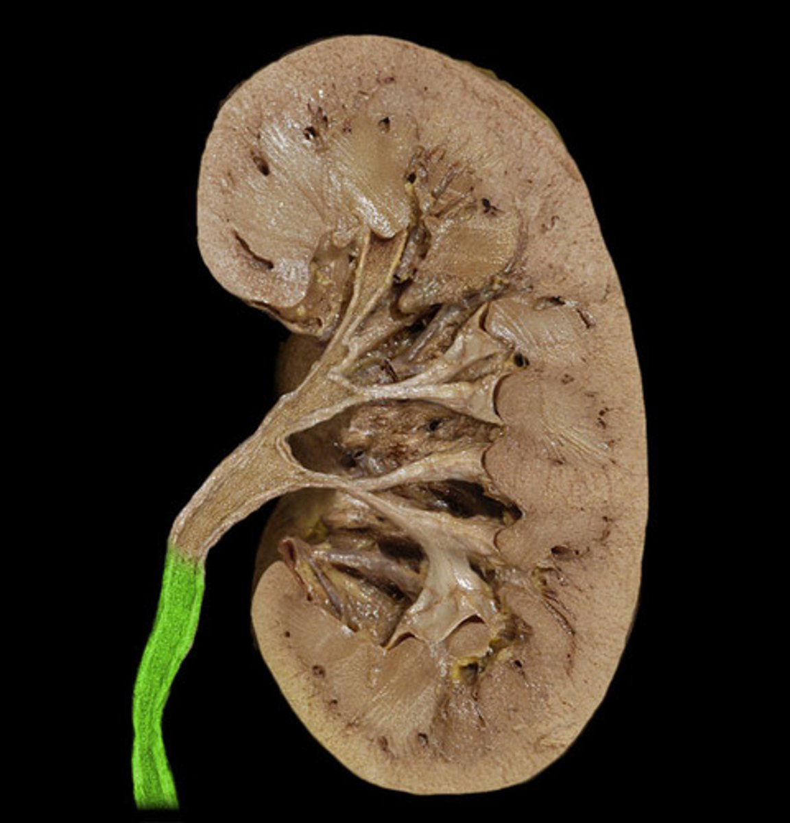 <p>tube that carries urine from the kidney to the urinary bladder</p>