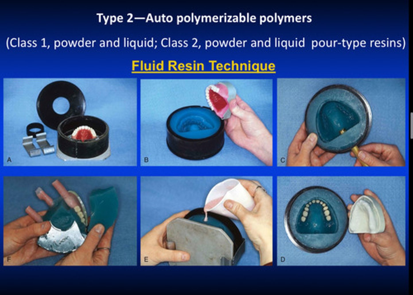 <p>used for class 1 (powder and liquid) and class 2 (powder and liquid pour-type resins) for type 2</p><p>resin is very flowable and can fill the cavity in between the denture teeth and the cast</p>