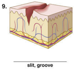 <p><span style="color: red">F Match each of the following lesions with their illustrations in Figure 16-26.</span></p><p></p>