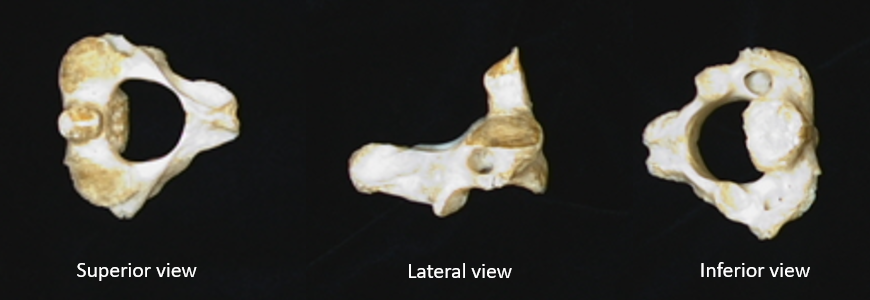 name the bone, be specific 
